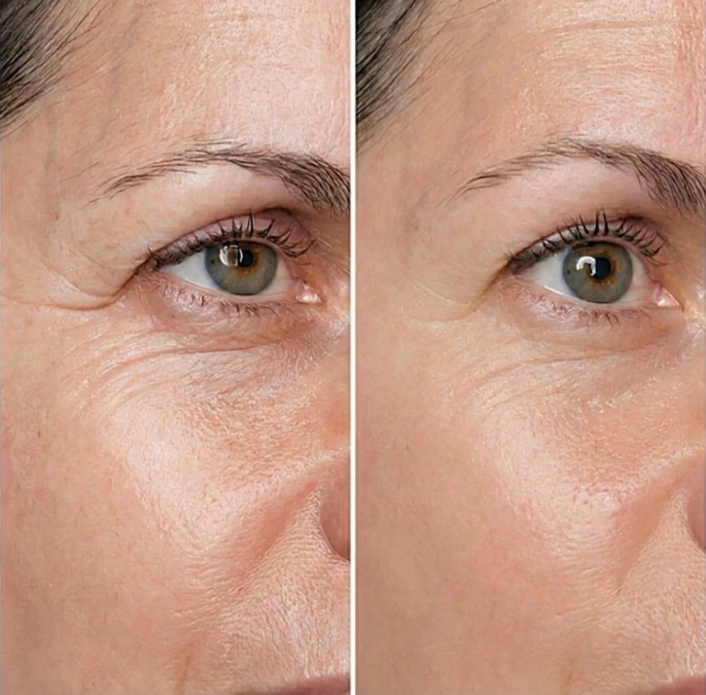 SilkFusion™ Peptide Lifting Serum