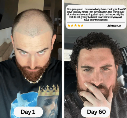 HerbalRoot™ Roll-On Serum