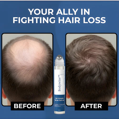 HerbalRoot™ Roll-On Serum