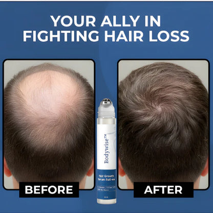 HerbalRoot™ Roll-On Serum